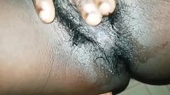 Hairy black Thumb