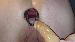 Swedish guy with speculum and dildo anal Thumb